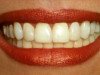 Mediķi aicina pievērst lielāku uzmanību zobu higiēnai